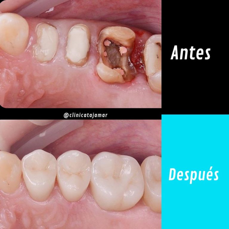 Casos antes y despues.pptx - 10