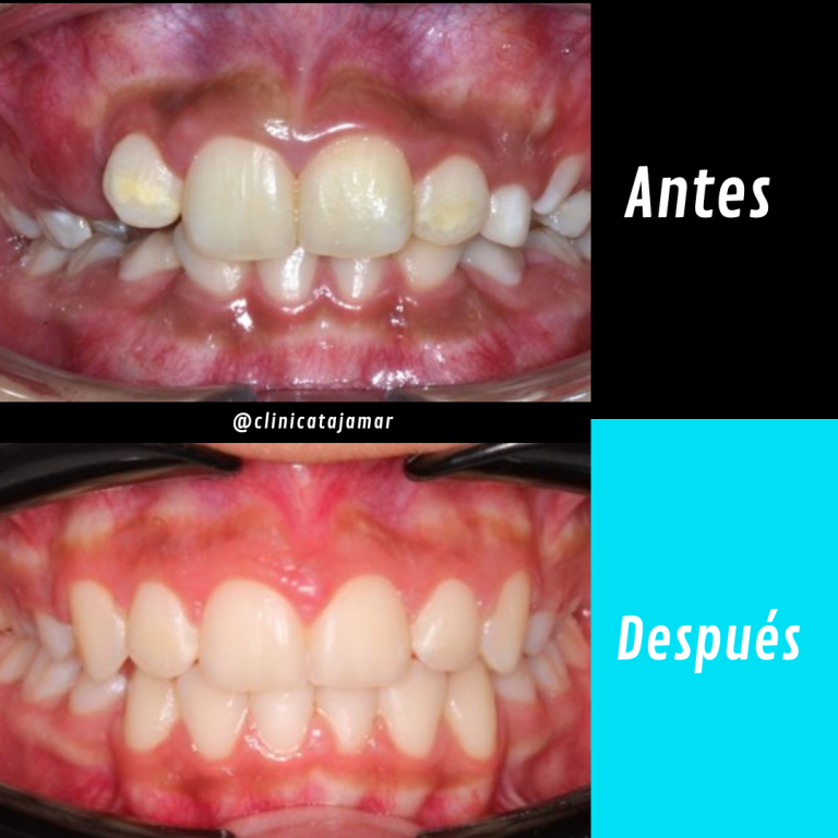 Casos antes y despues.pptx - 2