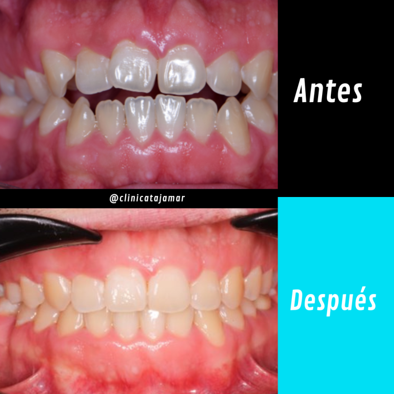 Casos antes y despues.pptx - 3