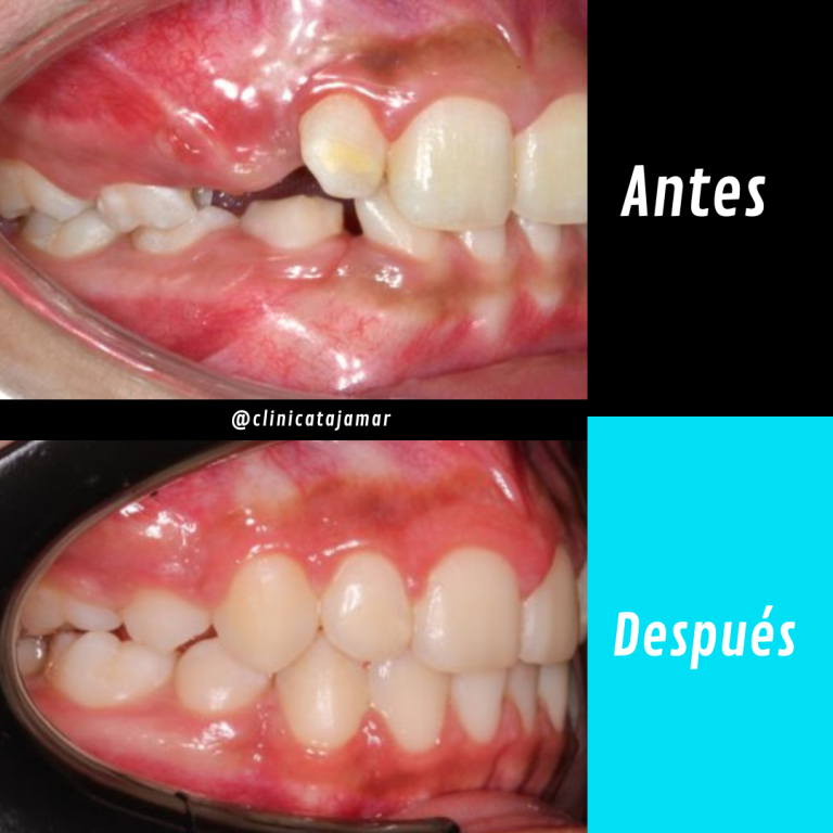 Casos antes y despues.pptx - 4