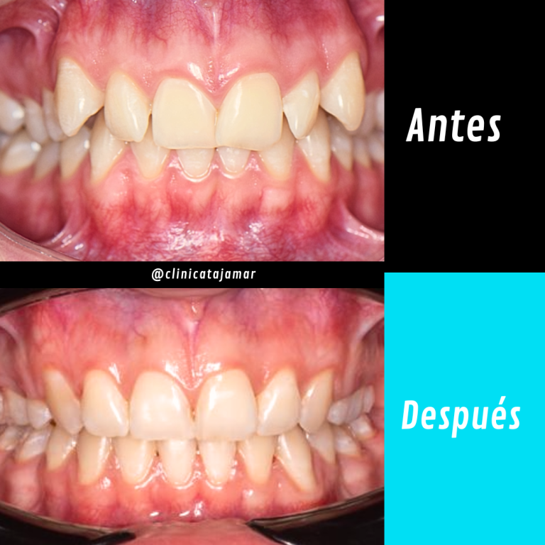 Casos antes y despues.pptx - 5