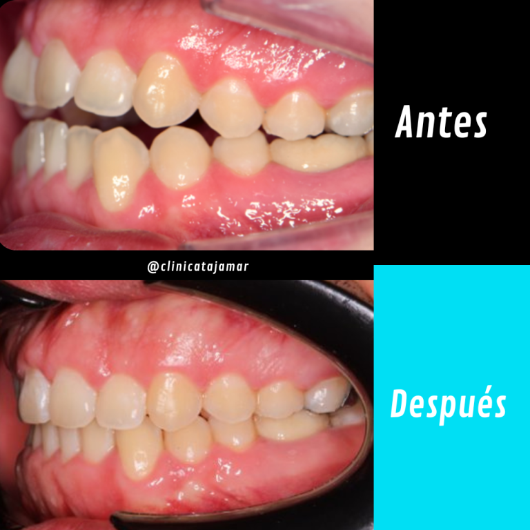 Casos antes y despues.pptx - 6