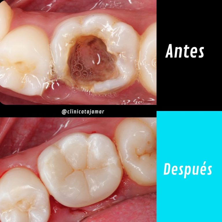 Casos antes y despues.pptx - 8