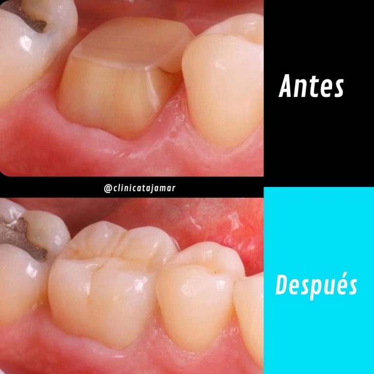 Casos antes y despues.pptx - 9